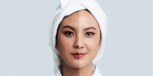 Cara meratakan warna kulit